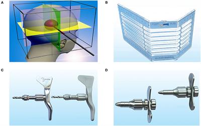 Minimally Invasive Surgery for Intracerebral and Intraventricular Hemorrhage